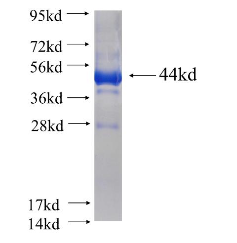 Recombinant human CSGALNACT2 SDS-PAGE