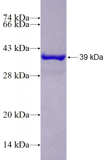 Recombinant Human S100A5 SDS-PAGE