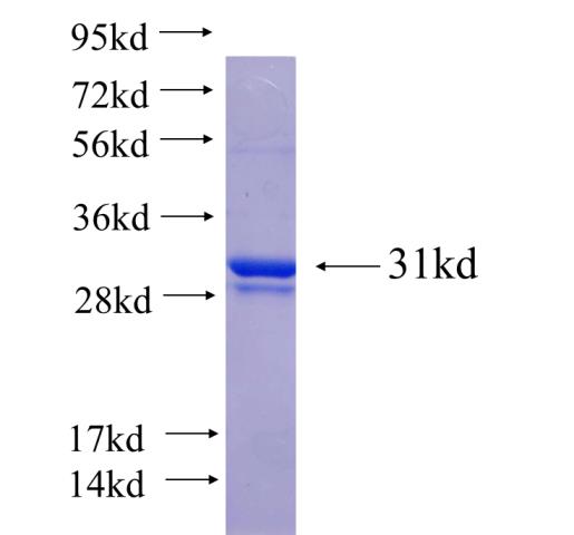 Recombinant human ZNF320 SDS-PAGE