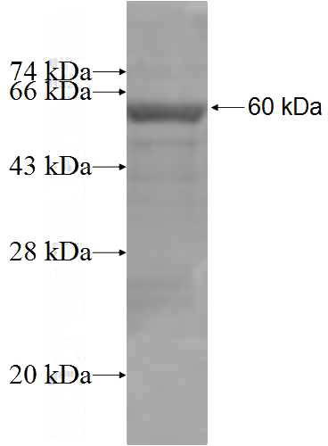 Recombinant Human UGCGL1 SDS-PAGE