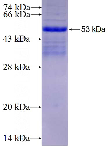 Recombinant Human PDLIM5 SDS-PAGE