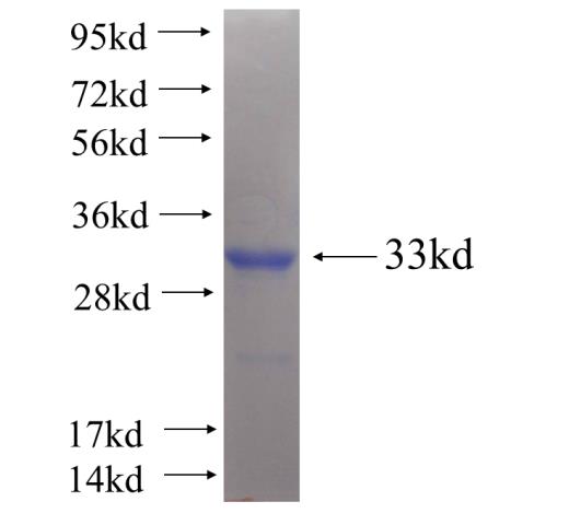 Recombinant human HSD17B8(Full length) SDS-PAGE