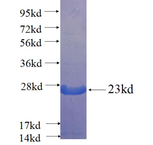 Recombinant human TFAP2E SDS-PAGE