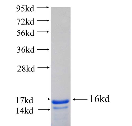 Recombinant human REEP4 SDS-PAGE