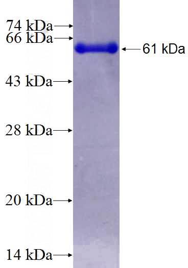 Recombinant Human SEPT9 SDS-PAGE