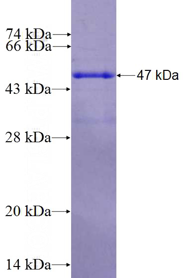 Recombinant Human TRAPPC10 SDS-PAGE
