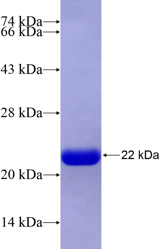 Recombinant Human MYH10 SDS-PAGE