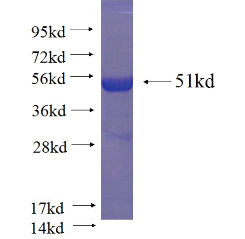 Recombinant human RAB27A SDS-PAGE