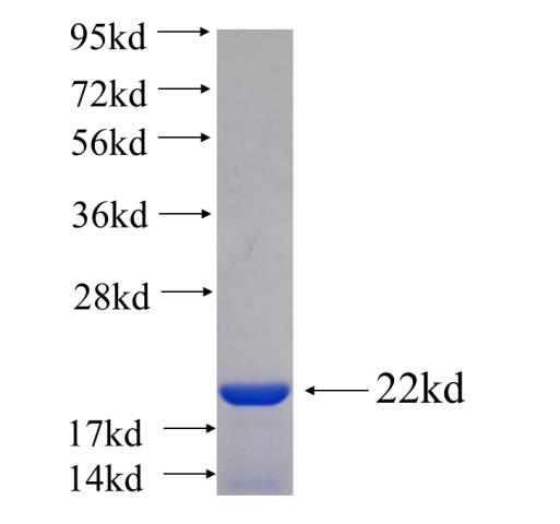 Recombinant human SLC39A7 SDS-PAGE