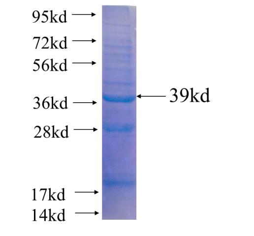 Recombinant human CAPN7 SDS-PAGE