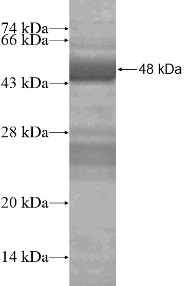 Recombinant Human CHSY3 SDS-PAGE