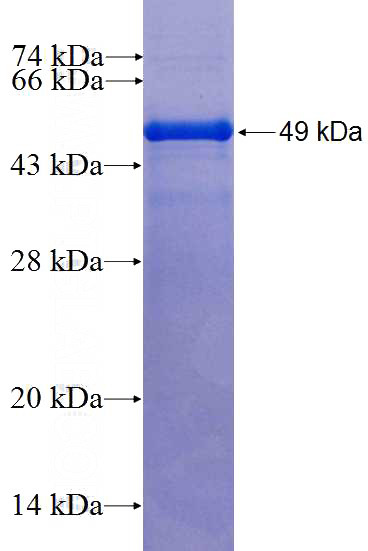 Recombinant Human ARHGDIA,aGDI SDS-PAGE