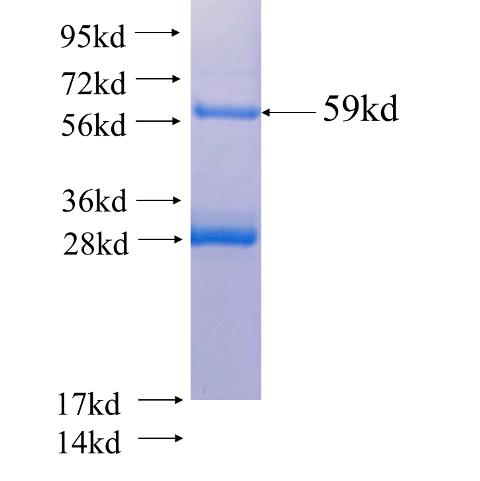 Recombinant human CYP11A1 SDS-PAGE