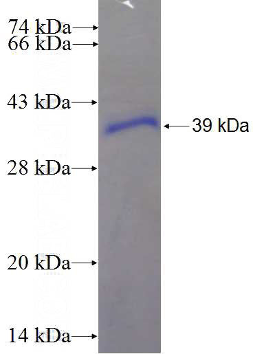 Recombinant Human RBBP6 SDS-PAGE