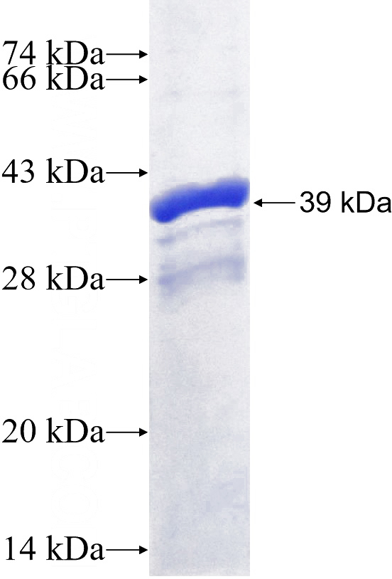 Recombinant Human MMP11 SDS-PAGE