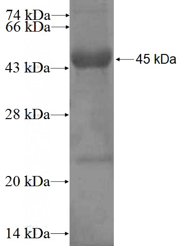 Recombinant Human CCNDBP1 SDS-PAGE