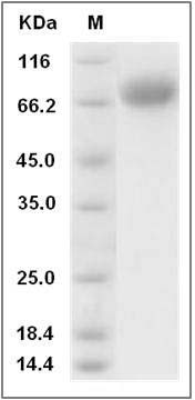 Rat BCAM Protein (His Tag) SDS-PAGE