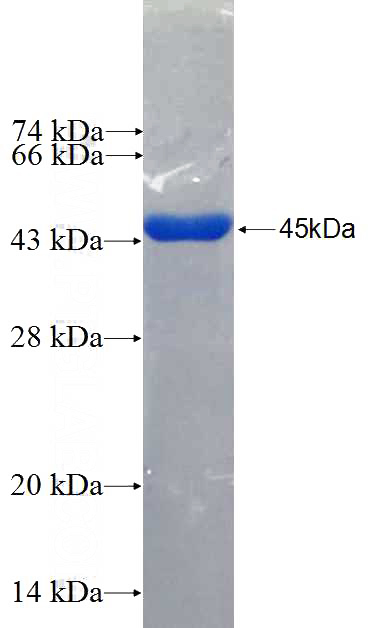 Recombinant Human EP300 SDS-PAGE