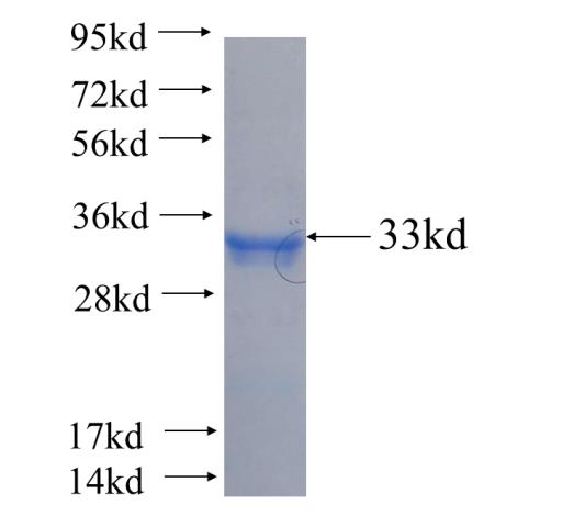 Recombinant human CCNB2 SDS-PAGE
