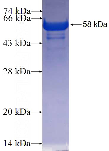 Recombinant Human ARHGAP28 SDS-PAGE