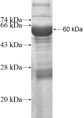 Recombinant Human KLHDC9 SDS-PAGE