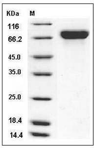 Influenza A H1N1 (A/Texas/05/2009) Hemagglutinin / HA Protein (His Tag) SDS-PAGE