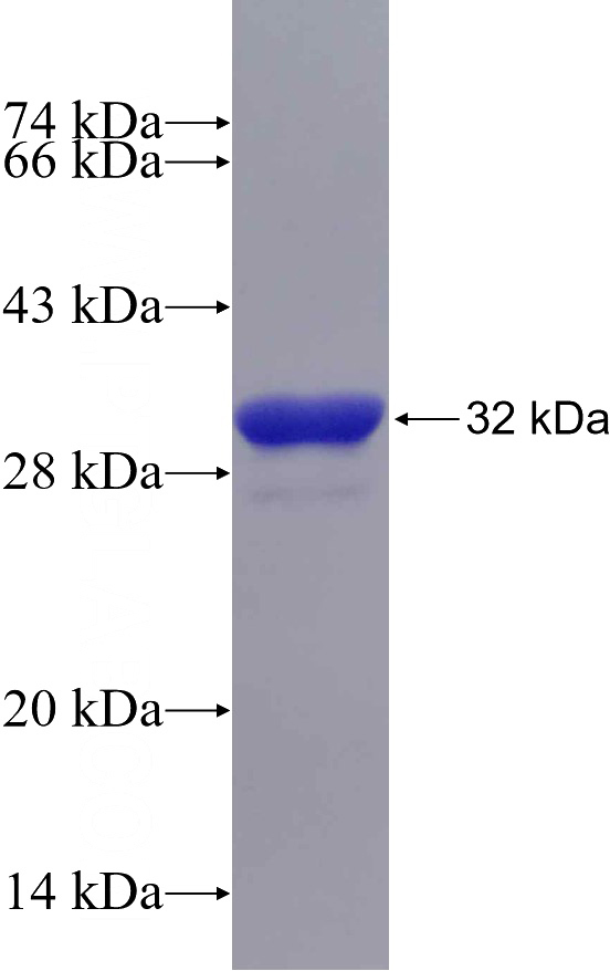 Recombinant Human USP15 SDS-PAGE