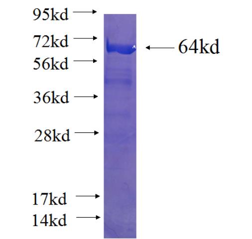 Recombinant human YAP1 SDS-PAGE