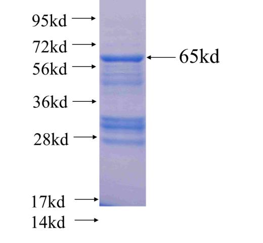 Recombinant human FOXO1 SDS-PAGE