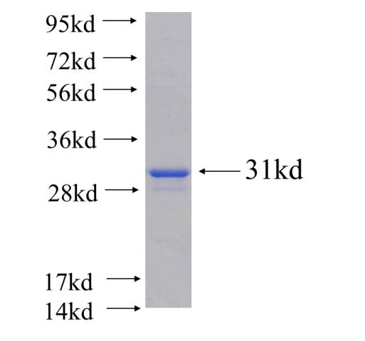 Recombinant human CRYBA4 SDS-PAGE