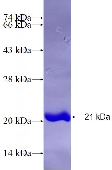 Recombinant Human MRFAP1 SDS-PAGE