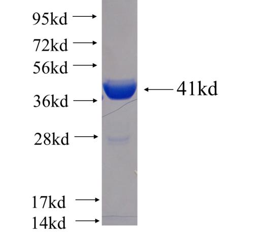 Recombinant human KIF5B SDS-PAGE