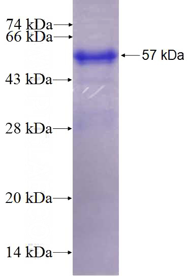 Recombinant Human MALRD1 SDS-PAGE