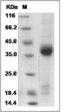 Human RPRD1B Protein (His Tag) SDS-PAGE