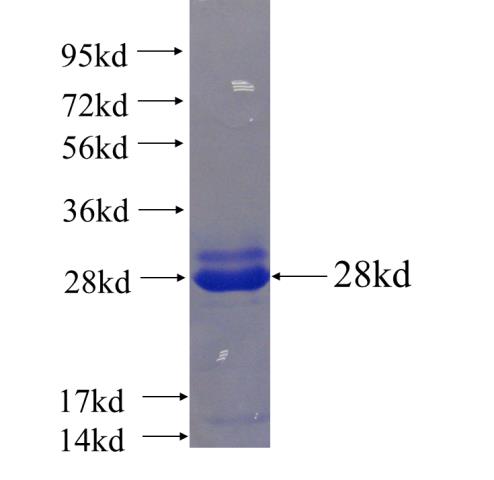 Recombinant human NDUFB5 SDS-PAGE