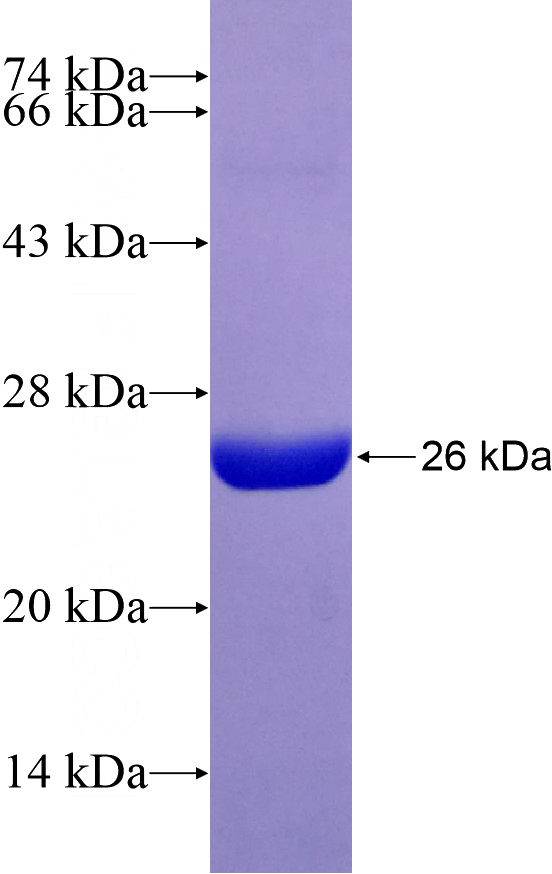 Recombinant Human NAT15 SDS-PAGE