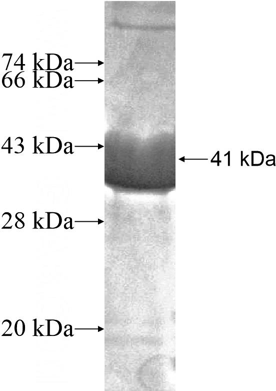 Recombinant Human PCDHGB1 SDS-PAGE