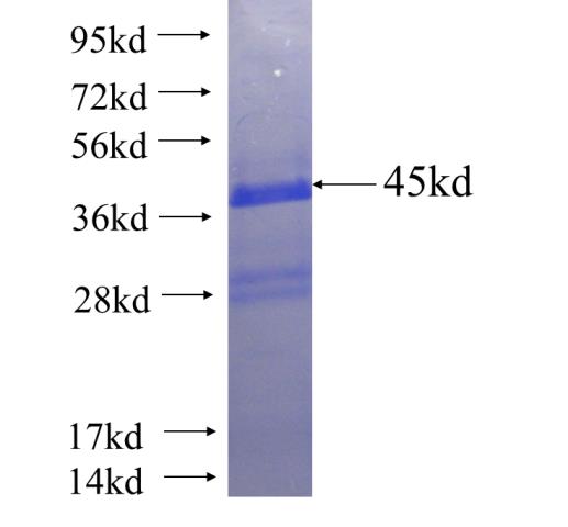 Recombinant human NESP55,GNAS SDS-PAGE
