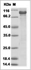 Human CHK2/CHEK2 Protein (GST Tag)