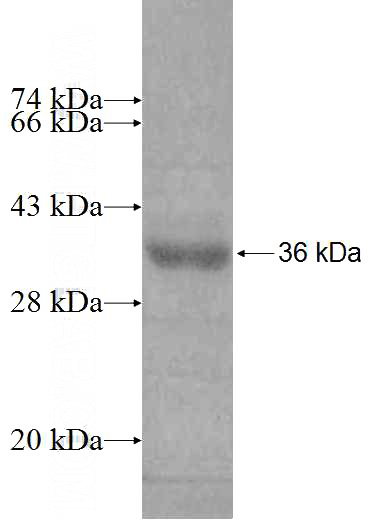 Recombinant Human RASD2 SDS-PAGE
