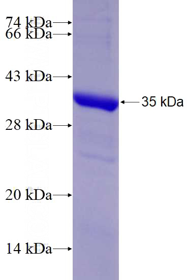 Recombinant Human VAV2 SDS-PAGE