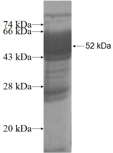 Recombinant Human THTPA SDS-PAGE