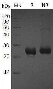 Mouse Cd40/Tnfrsf5 (His tag) recombinant protein