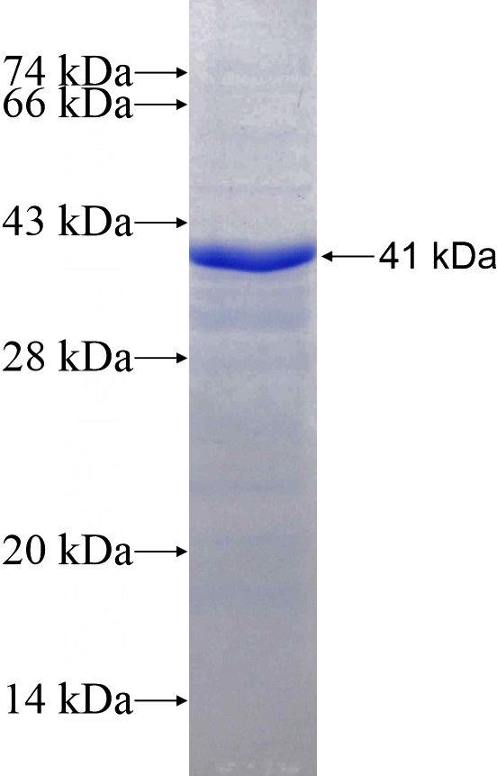 Recombinant Human NOTUM SDS-PAGE
