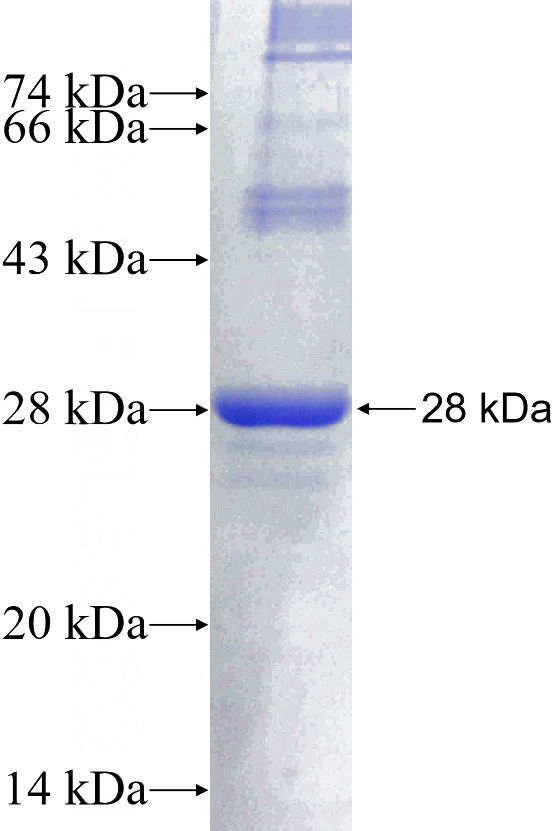 Recombinant Human MRPL12 SDS-PAGE