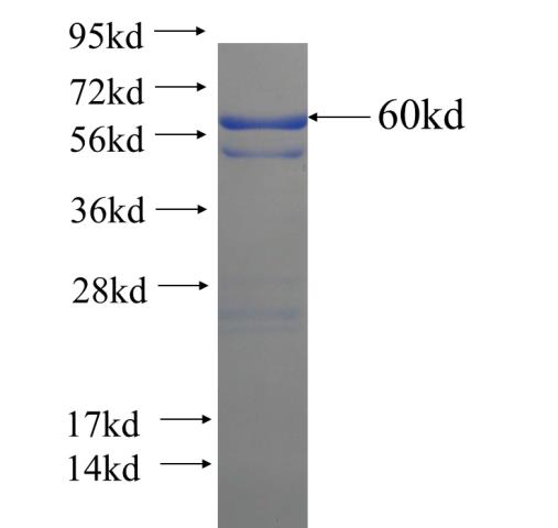 Recombinant human C2CD2L SDS-PAGE