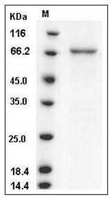 Human TPL2 / MAP3K8 / MEKK8 Protein (GST Tag) SDS-PAGE