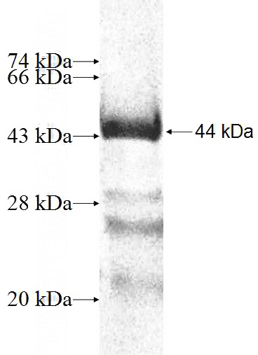 Recombinant Human NPHP5,IQCB1 SDS-PAGE