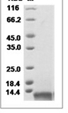Rat CCL5 recombinant protein (C-His)