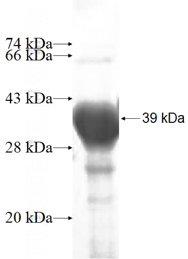 Recombinant Human SMPD2 SDS-PAGE